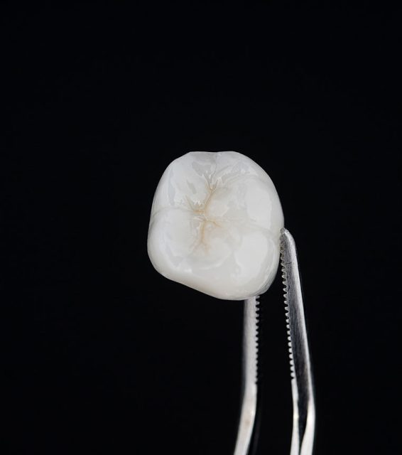 a dental crown