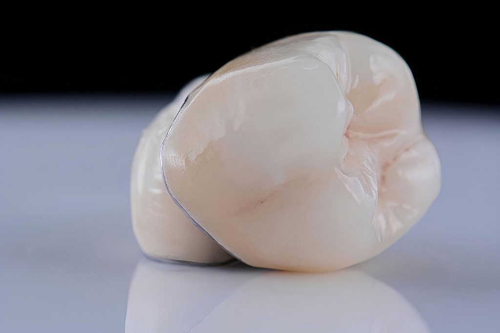 dental crowns near you